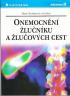 Onemocnn lunku a luovch cest